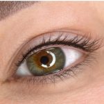 Wimpernkranzverdichtung